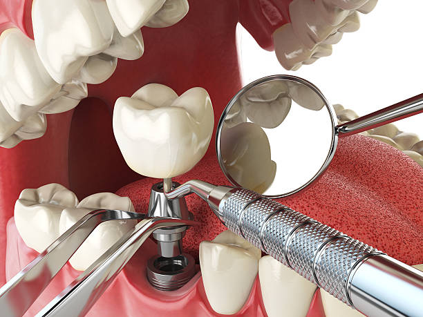 Best Emergency Denture Repair in Lamar, TX